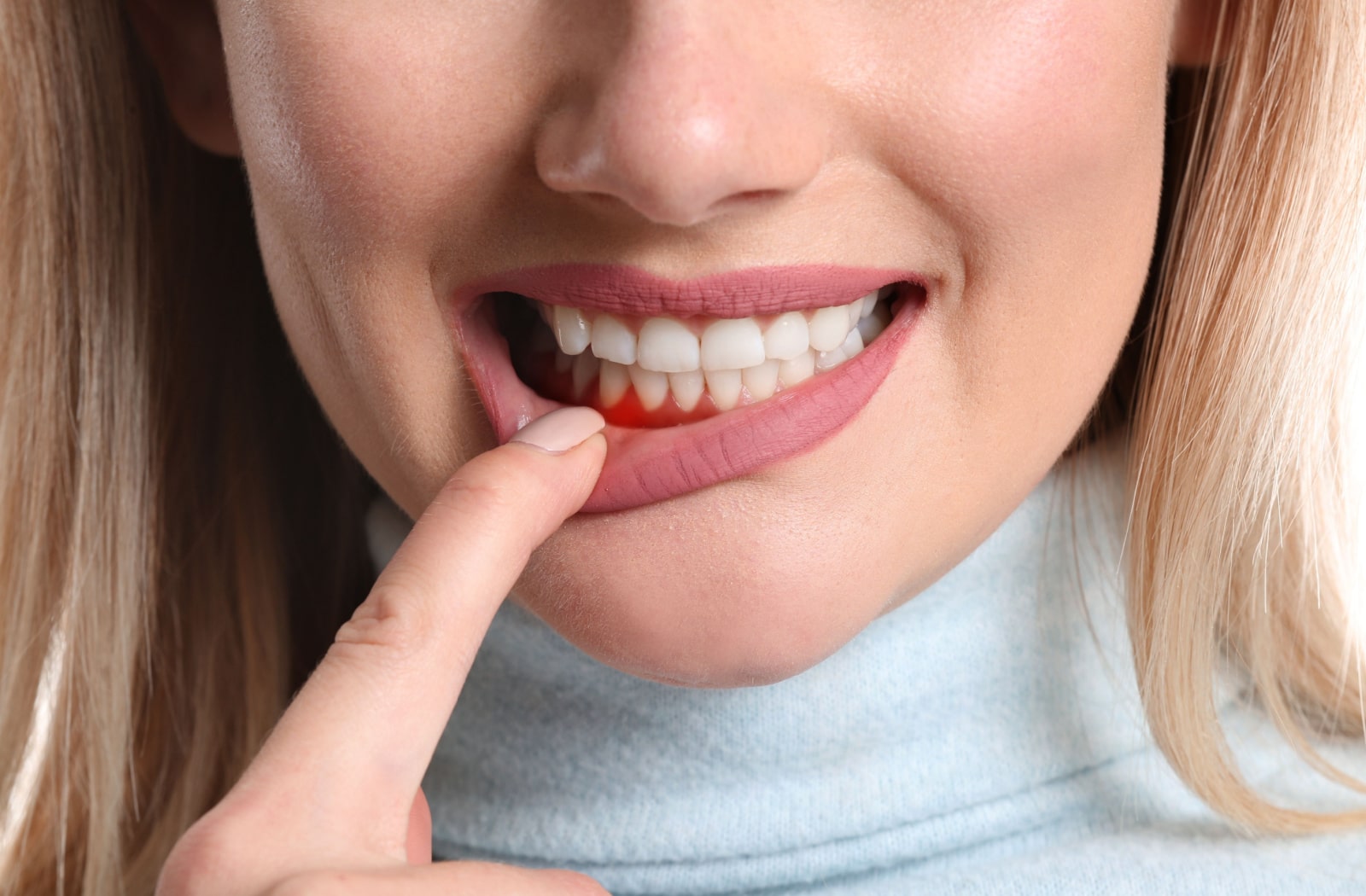 A woman pulls down the side of her lip with her index finger, showing inflammation to her gums